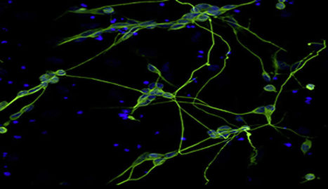 Researchers Convert Skin and Umbilical Cord Cells Directly into Nerve Cells | Science News | Scoop.it