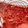 Critical Limb-Threatening Ischemia (CLTI)