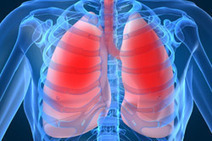 CTC Test Useful for Tracking Progress of Mesothelioma and Lung ... | from Flow Cytometry to Cytomics | Scoop.it