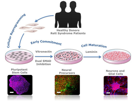 Neural Commitment of Human Pluripotent Stem Cells Under Defined Conditions Recapitulates Neural Development and Generates Patient-specific Neural Cells | iBB | Scoop.it