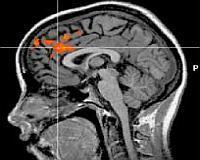 This is your brain on no self-control | Science News | Scoop.it