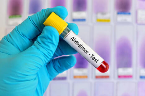 Un an&aacute;lisis de sangre para detectar el Alzheimer podr&iacute;a no funcionar igual en todo el mundo | Alzheimer y m&aacute;s (Bolet&iacute;n n&ordm; 95) | Scoop.it