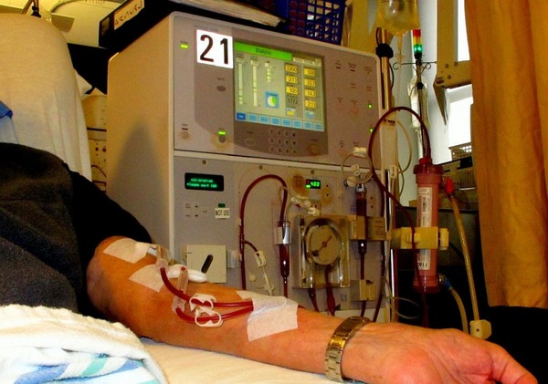 Fresenius Medical Care Partners with JMS Co. Ltd. to Advance Home Dialysis Treatment in Japan | Peritoneal dialysis | Scoop.it