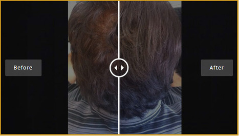 Febron Com Top 5 Hairstyles For Thin Hair H