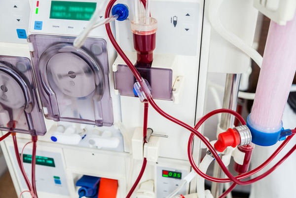 Home dialysis in the COVID-19 era and beyond | Peritoneal dialysis | Scoop.it