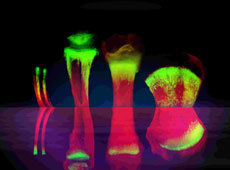 Advances in stem cell therapy for cartilage regeneration in osteoarthritis: Expert Opinion on Biological Therapy: Vol 0, No ja | Rheumatology-Rhumatologie | Scoop.it