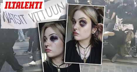 Tytti, 26, julkaisi kuvan pahoinpitelyss&auml; mustuneesta silm&auml;st&auml;&auml;n &ndash; Pian h&auml;n joutui julkaisemaan videon, jossa &rdquo;pesee&rdquo; sit&auml; | 1Uutiset - Lukemisen t&auml;hden | Scoop.it
