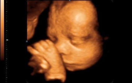 Shocker: the dangers of Ultrasound « | Health Supreme | Scoop.it
