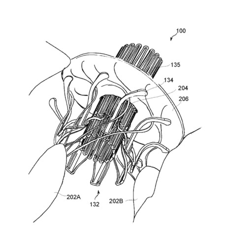 WO2013175468A2 PROSTHETIC MITRAL VALVE | Transcatheter Treatment of Mitral Regurgitation | Scoop.it