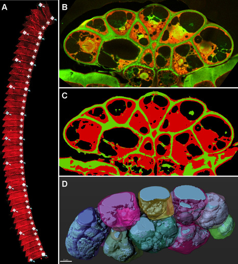 FOCUS PLATEFORME : Combiner la microscopie photonique spectrale automatisée et le machine learning au service d’un protocole d'imagerie quantitative 3D de grands volumes | Life Sciences Université Paris-Saclay | Scoop.it