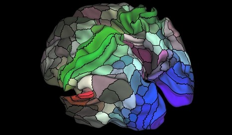 Putting a computer in your brain is no longer science fiction | Chair et M&eacute;tal - L'Humanit&eacute; augment&eacute;e | Scoop.it