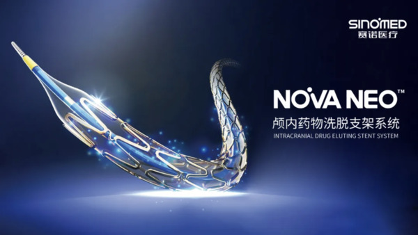 Clinical Application of the NOVA NEO&trade; Intracranial Drug-Eluting Stent in the Recanalisation Treatment of Acute Middle Cerebral Artery Occlusion | Neurovascular Intervention | Scoop.it