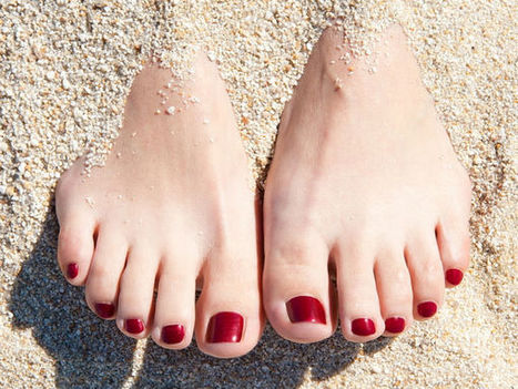 Cure Dry Palms & Feet This Summer | HealthNFitness | Scoop.it