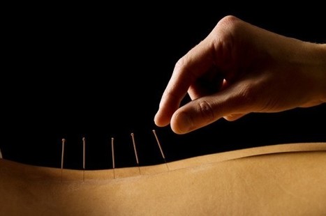 ¿Funciona la acupuntura o es un placebo milenario? - Plcbo.net | Escepticismo y pensamiento crítico | Scoop.it