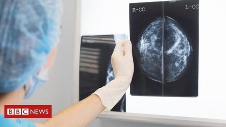 AI 'outperforms' doctors diagnosing breast cancer | Hospitals and Healthcare | Scoop.it