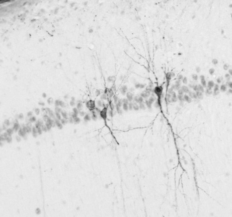 Les agr&eacute;gats de Tau : peut-&ecirc;tre pas si toxiques qu&rsquo;on le croyait ? | Life Sciences Universit&eacute; Paris-Saclay | Scoop.it