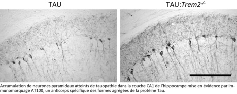 Trem2 au secours de la microglie pour éliminer les agrégats de Tau | Life Sciences Université Paris-Saclay | Scoop.it