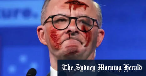 Bloodied Albanese ads part of scammer Christmas blitz | Avoid Internet Scams and ripoffs | Scoop.it