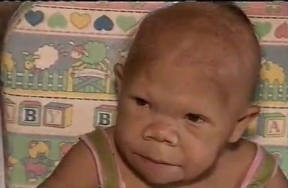 30-Year Old Brazilian Woman Looks Like a 9-Month Baby | Strange days indeed... | Scoop.it