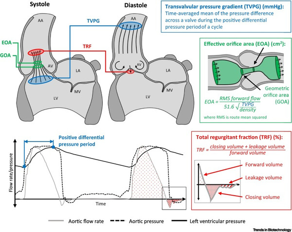 3D printing of heart valves | Transcatheter Treatment of Mitral Regurgitation | Scoop.it