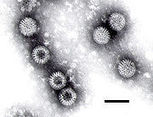 Study shows safety of rotavirus vaccine | Vaccine News Daily | Virology News | Scoop.it