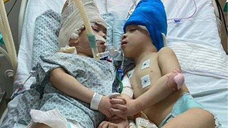VR Technology Used To Help Separate Conjoined Twins | Imagine Online International Education | Scoop.it