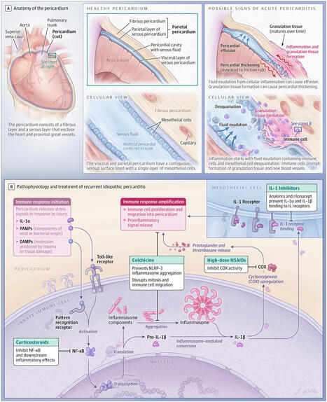 Diagnosis, Risk Stratification, and Treatment of Pericarditis: A Review | Cardiology | JAMA | JAMA Network | Comprehensive Geriatric Assessment | Scoop.it