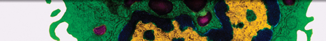 Synovial Macrophages in Rheumatoid Arthritis: The Past, Present, and Future | Rheumatology-Rhumatologie | Scoop.it