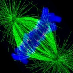 UW researchers improve microscopy method to ‘swell’ cellular structures, bringing fine details into view  | Bioscience News - GEG Tech top picks | Scoop.it