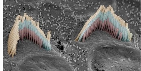 Gu&eacute;rir le syndrome d&rsquo;Usher par th&eacute;rapie g&eacute;nique | Revue de presse Implant Cochl&eacute;aire | Scoop.it