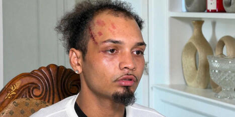'They wanted to kill me': New York man speaks out after ICE mistakenly beats him - Raw Story | Backstabber Watch | Scoop.it