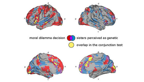 How the Brain Reacts to Difficult Moral Issues | Coaching & Neuroscience | Scoop.it