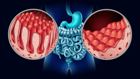 How Does The Digestive System Work? | Navigating Healthcare | Medical and Health | Scoop.it