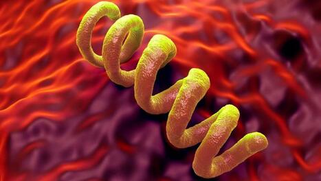 Le retour de la syphilis dans le sillage des pratiques sexuelles &agrave; risque - France - RFI | sida | Scoop.it