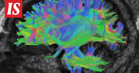 Tutkimus: Aivoilla on neljä ratkaisevaa ikää – 9, 32, 66 ja 83 | 1Uutiset - Lukemisen tähden | Scoop.it