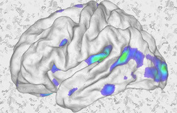 ECTRIMS Multiple Sclerosis Nurse Training Programme | NeuroImmunology | Scoop.it