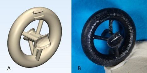 Doctors Are 3D Printing Ear Bones To Help With Hearing Loss | Amazing Science | Scoop.it