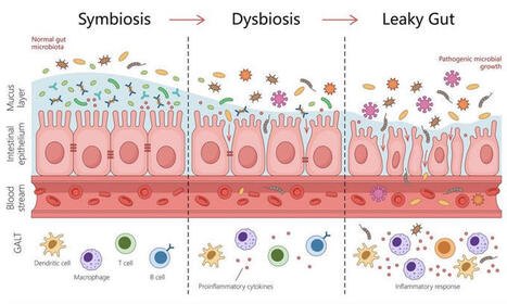 #sant&eacute;fonctionnelle #maladieautoimmune #microbiote #leakygut #hyperperm&eacute;abilit&eacute; | Dr Nicolas Dedieu PharmD | 43 comments | AUTOIMMUNITY | Scoop.it