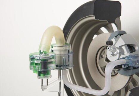 &laquo;&nbsp;Les r&eacute;sultats des municipales montrent que l'&eacute;cologie &eacute;tait partout&nbsp;&raquo; | Elections - Municipales 2026 | Scoop.it