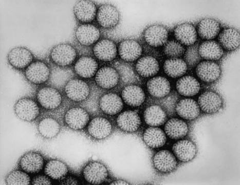 Lower risk of type 1 diabetes found in children vaccinated against rotavirus | Virus World | Scoop.it