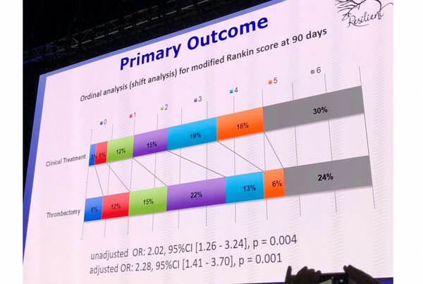 The “overwhelming” efficacy of mechanical thrombectomy pursues in developing countries: RESILIENT, the final results | Neurovascular Intervention | Scoop.it