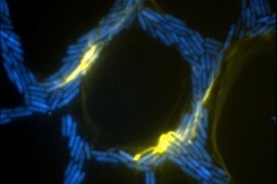 Scientists one step closer to preventing bacterial infections of implanted medical devices | UTS News Room | Healthcare: reloaded... | Scoop.it