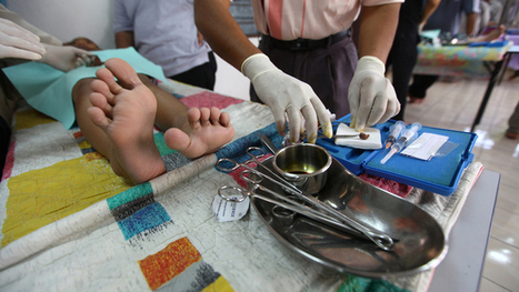 Circumcision: No harm in asking the question | Life Orientation resources for South African teachers | Scoop.it