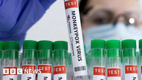 Une épidémie de variole en République démocratique du Congo préoccupe les autorités : une nouvelle souche du virus mpox contient des mutations qui semblent l'aider à circuler parmi les humains | EntomoNews | Scoop.it
