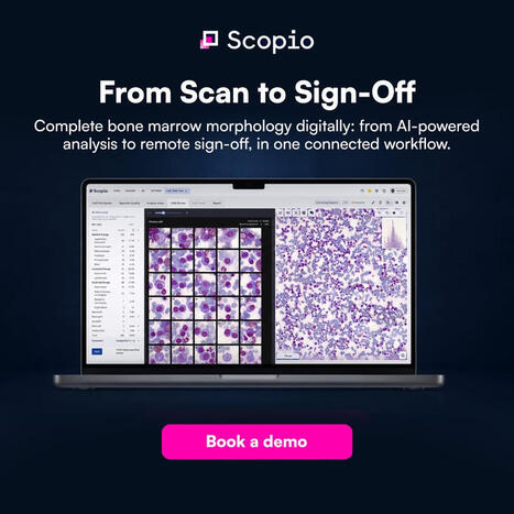 Scopio Labs - Bone marrow aspirate analysis is going fully... | Hematology | Scoop.it