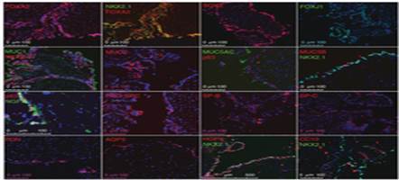 Efficient generation of lung and airway epithelial cells from human pluripotent stem cells | Genetic Engineering Publications - GEG Tech top picks | Scoop.it