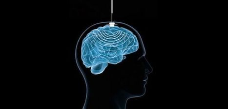 La Méthode scientifique | Culture : "Implants cérébraux, demain tous pucés | Ce monde à inventer ! | Scoop.it