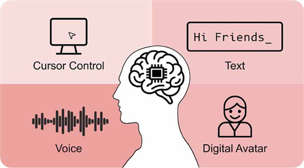 But do we need high bandwidth? Applications and scaling challenges of invasive brain&ndash;computer interfaces | Brain Computer Interfaces & connected medical devices | Scoop.it