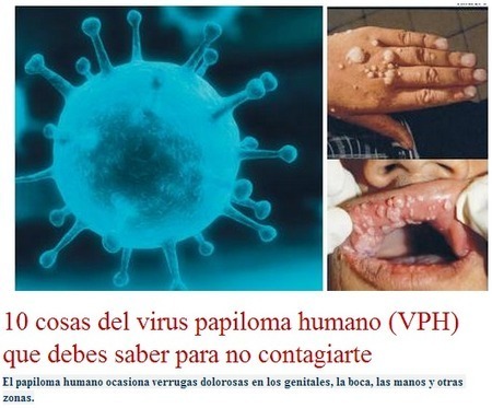 10 cosas del virus papiloma humano que debes saber para no contagiarte + 10 señales que revelan una apendicitis | PIENSA en VERDE | Scoop.it