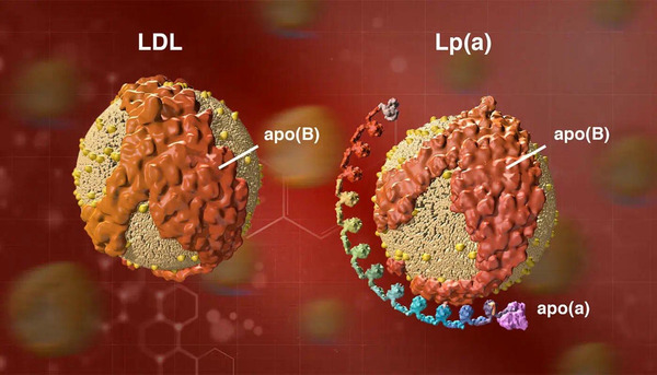 Who Should Have Lp(a) Levels Tested? Experts Take Sides | Neurovascular Intervention | Scoop.it